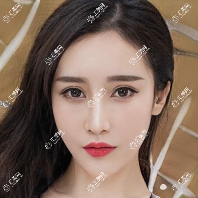 呼和浩特眼科激光及整形医生推荐,这些医生备受信赖