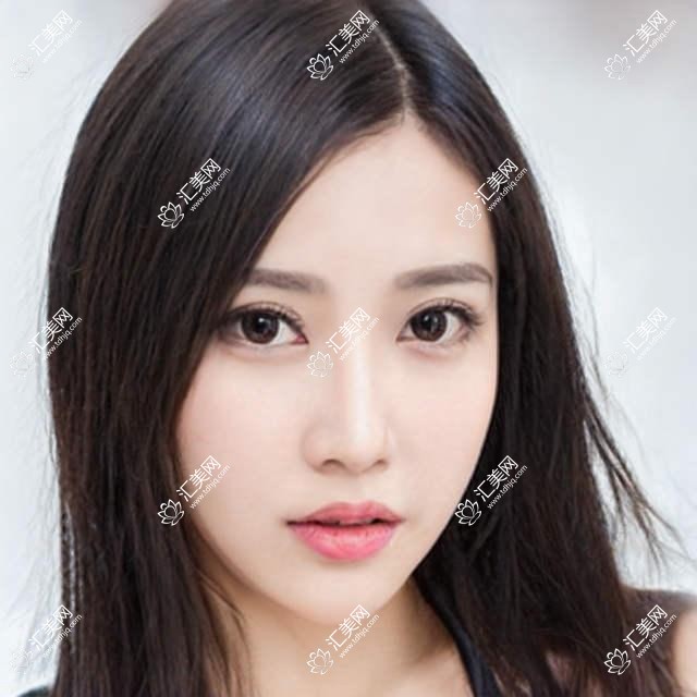 成都瞳康眼科项目价目表曝光!2万起多面呵护视力,性价比高!
