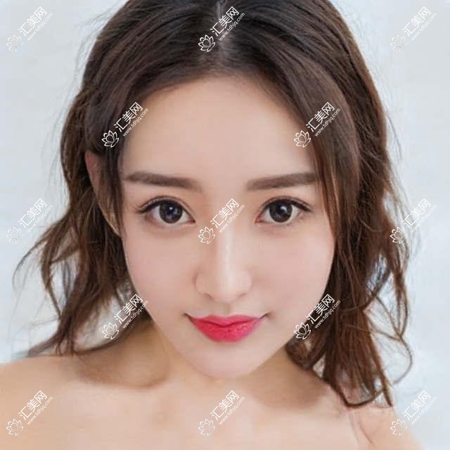 北京爱仁眼科项目价格大全:半飞秒全飞秒近视散光矫正+TICL ICL晶体植入费用明细