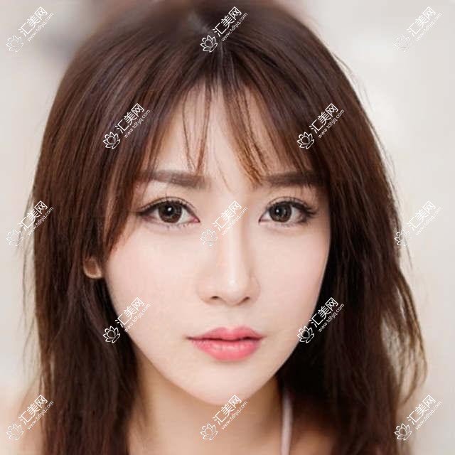 成都温江维普眼科眼科项目价格揭秘:近视激光&白内障手术费用一览