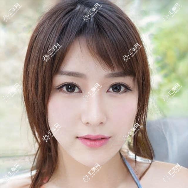 重庆成佳牙博士口腔唐绿叶李荣医生人工种植牙技术如何?还有其他全口种植医生吗?