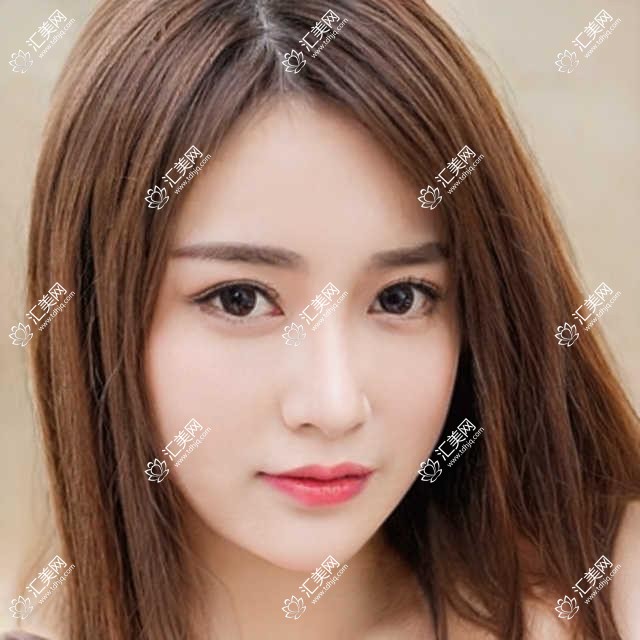 洛阳云亮口腔揭秘：牙齿矫正、美白项目价格大公开！