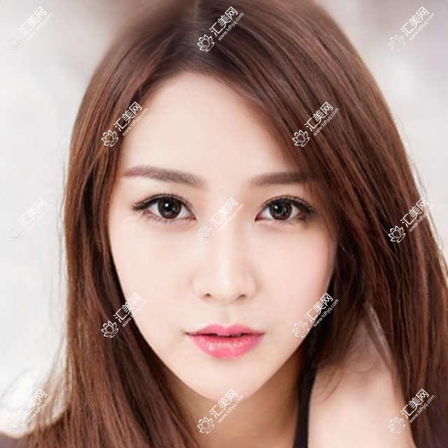 上海市雅冠林口腔正畸费用多少?隐形矫正2W+ 牙齿美白5K+ 种植牙1W5+