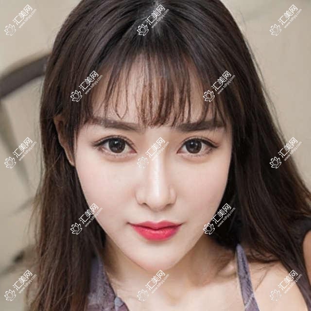 临沂眼科医生田作龙闫莹擅长白内障及近视手术,技术如何?