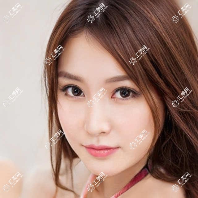 深圳瑞美口腔全项目价格表:牙套矫正