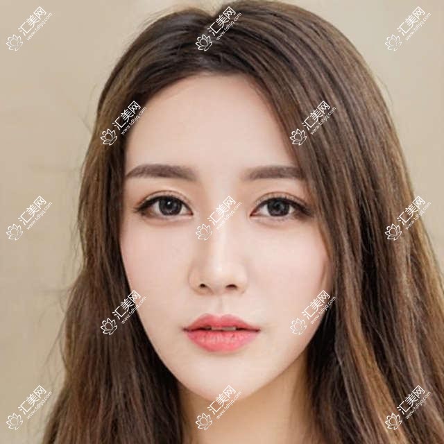 郑州牙齿美容修复推荐医生有哪些?陈庭威董如意周弘等医生精通烤瓷牙种植