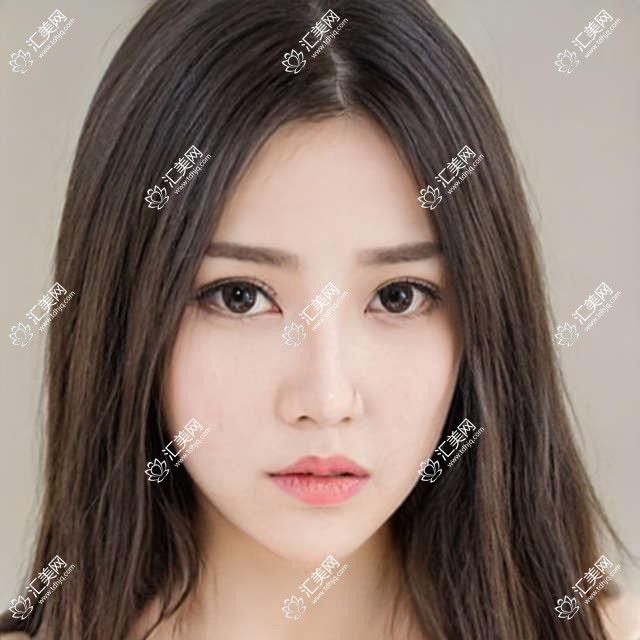 青岛种植牙名医汇聚!胡克林、张国权等医生技术精细,口碑优良,全口种植牙优选!