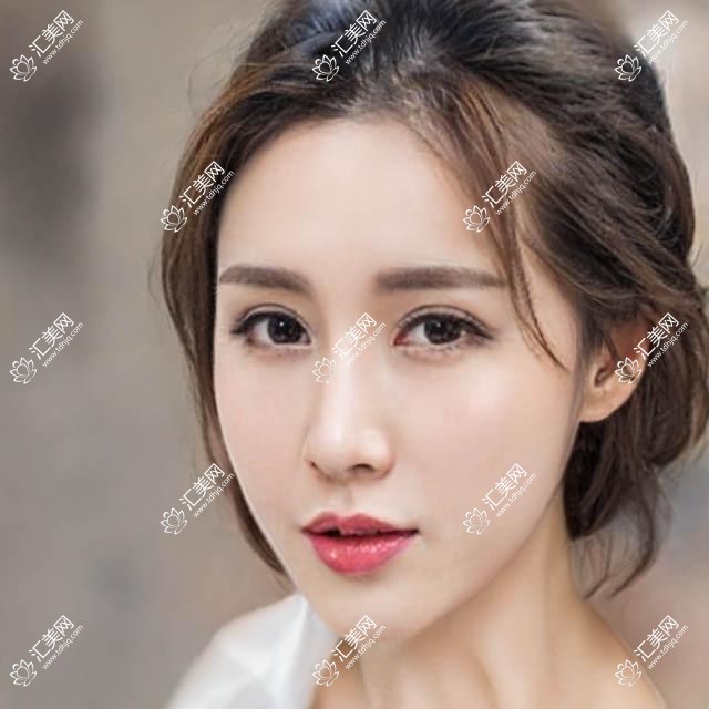 济南眼科名医推荐：高华、王超、刘蕾精通近视手术及眼部整形，技术精细，好评如潮！