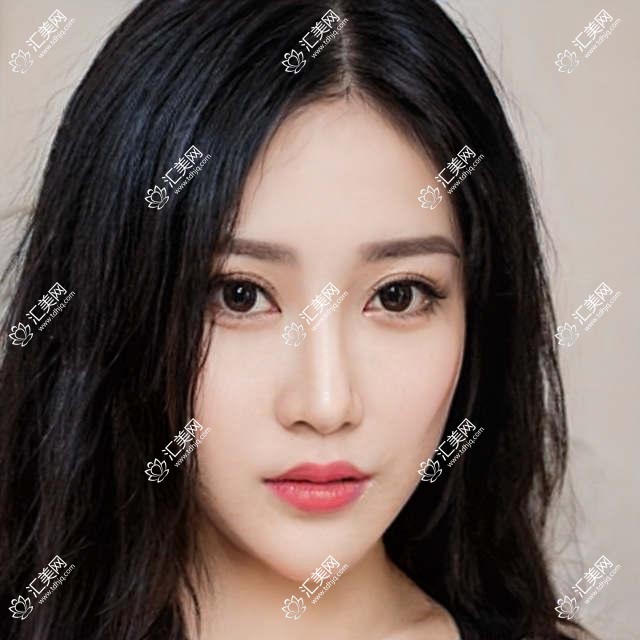 哈尔滨牙齿矫正种植医生推荐：刘远航、林美岑、杨桂茹擅长矫正种植