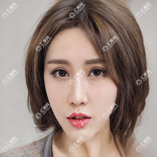 南宁眼科医生梁勇刘泉陈蒙如何治白内障近视?全飞秒手术受推崇