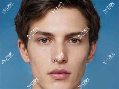 荆州眼科医生推荐：王海波陈莹领衔眼部手术，晶体植入与近视矫正优选