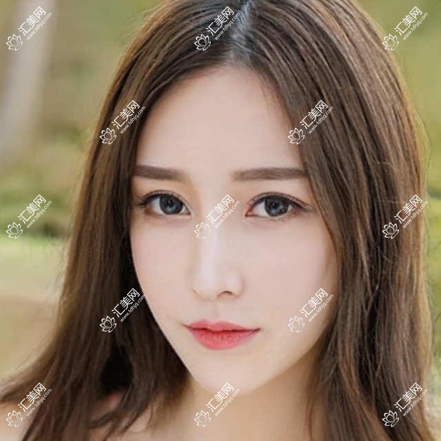 德州眼科医生梁玲领衔，推荐全飞秒等近视手术医生名单