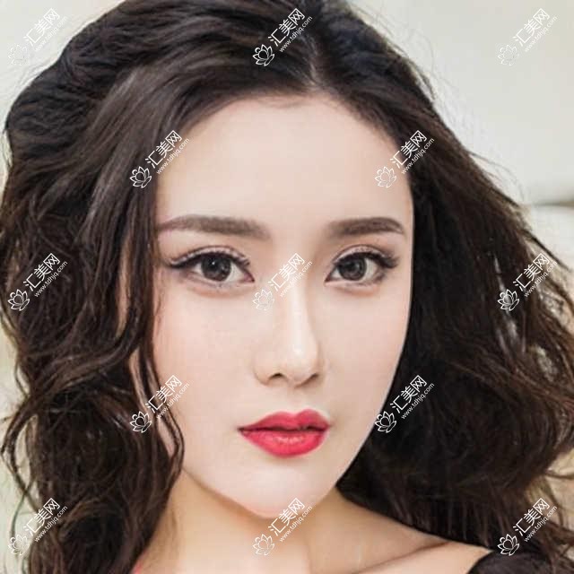 德州眼科医生梁玲领衔,擅长全飞秒等近视手术备受推崇