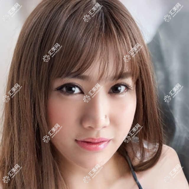 寻武汉这些眼科医生做屈光手术,眼部问题迎刃而解