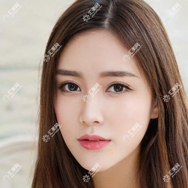 淮安近视手术医生陈绪攀排行推荐(含优势技术+费用详情)_爱尔眼科必看