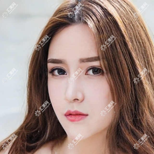 阜阳眼科医生蔡磊琳王丹梅精研激光近视矫正,晶体植入术备受好评