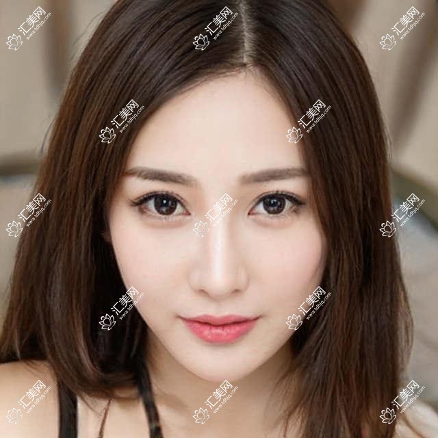 广州李耿雄口腔项目价目表曝光!全项仅需8千起,实惠又安心!