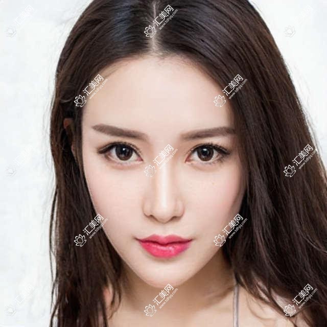 武汉观视界眼科价格揭秘:近视手术、白内障治疗等项目费用一览