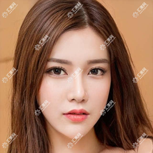 东莞优选近视手术医生盘点!李鹏杜绍林梁秀栋技术获赞!