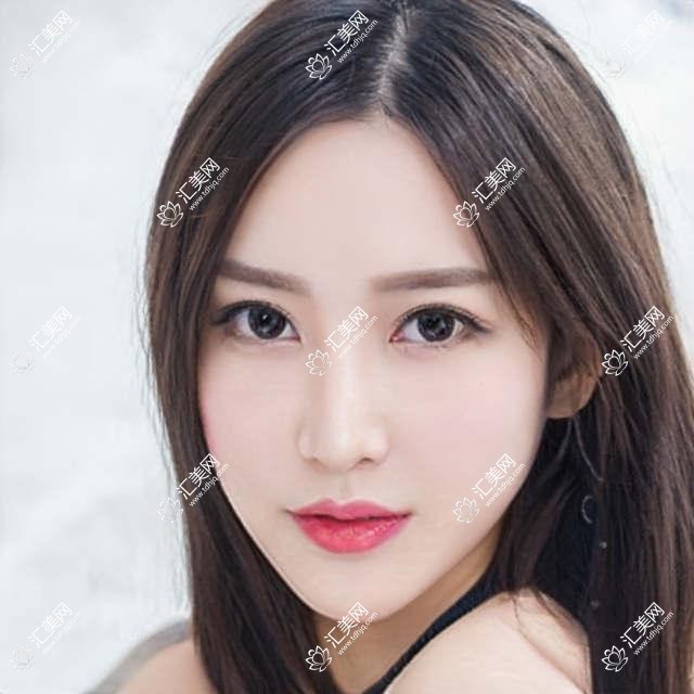三亚眼科医生张晓琴领衔,擅长全飞秒近视手术备受推崇