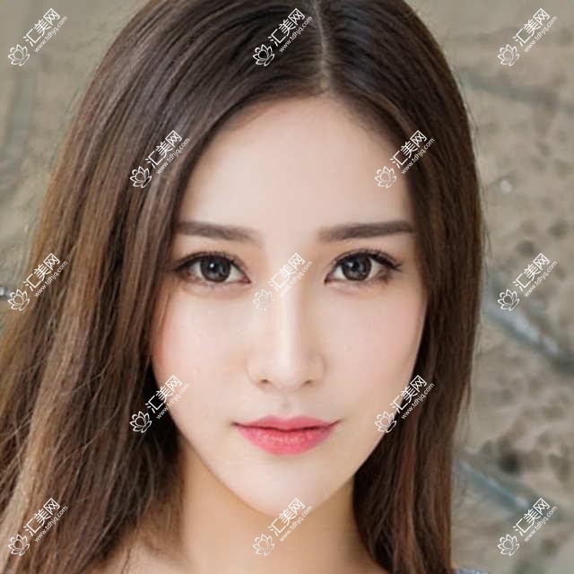 北京泛美医美项目价格揭晓:整形5000+美肤2000元起,实惠透明