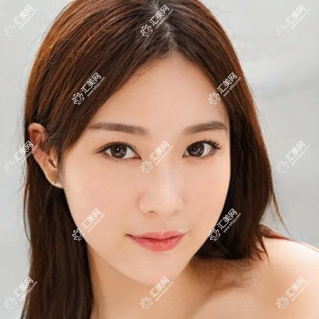 泰州眼科医生推荐白内障手术榜单(含优势项目+解析)_泰州看眼疾优选