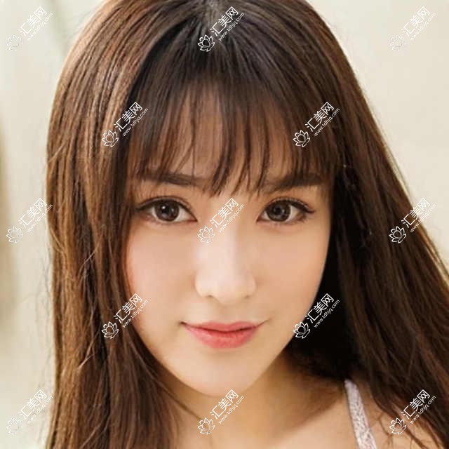 银川近视矫正医生吴博文、宋立新、李彦评测,半飞秒全飞秒ICL技术精细