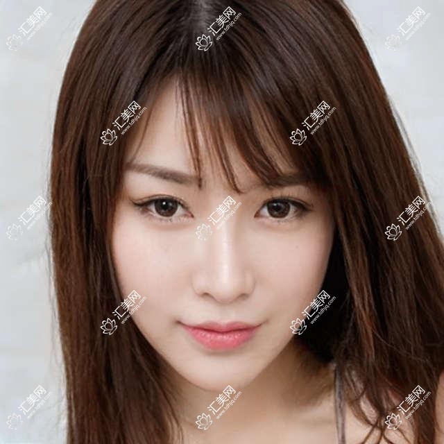 淮安爱尔眼科陈绪攀医生近视手术怎么样?还有哪位医生擅长视力矫正?