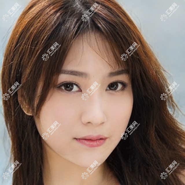 北京怀柔爱尔眼科全项目价格揭秘:近视激光、白内障手术等热门眼科项目一网打尽