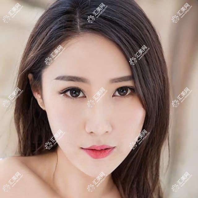 汕头康视眼科全项目价格表:近视远视矫正+老花白内障手术+晶体植入费用详解