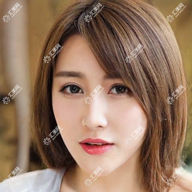 深圳黑马眼科项目价格揭晓!全项透明,近视手术6800起!