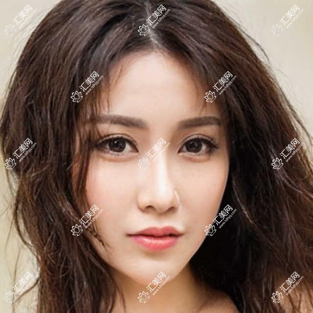 兰州眼科医生排行榜揭晓!近视矫正、白内障治疗高手齐聚,医院地址附上!