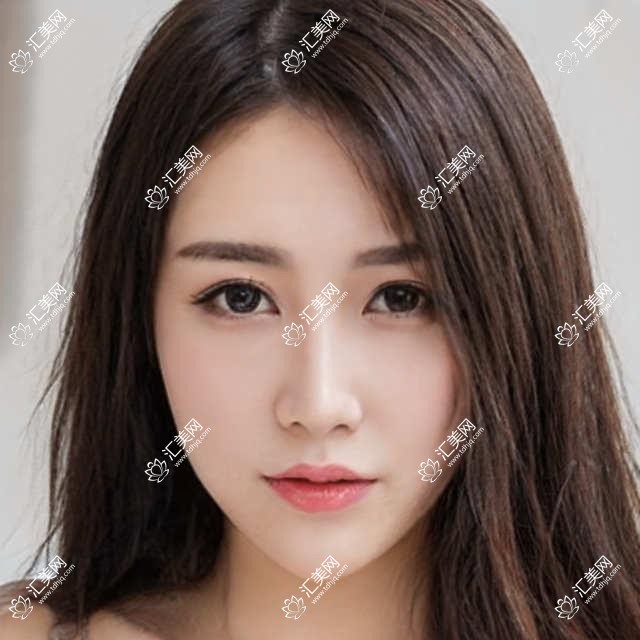 肇庆口碑医生推荐:黎贤强兰海松李焕初擅长人工种植牙及矫正技术