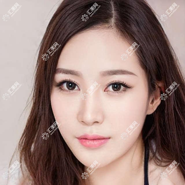 天津南开首爱眼科全项目价格一览:近视半飞秒全飞秒到白内障PRL晶体2800+起