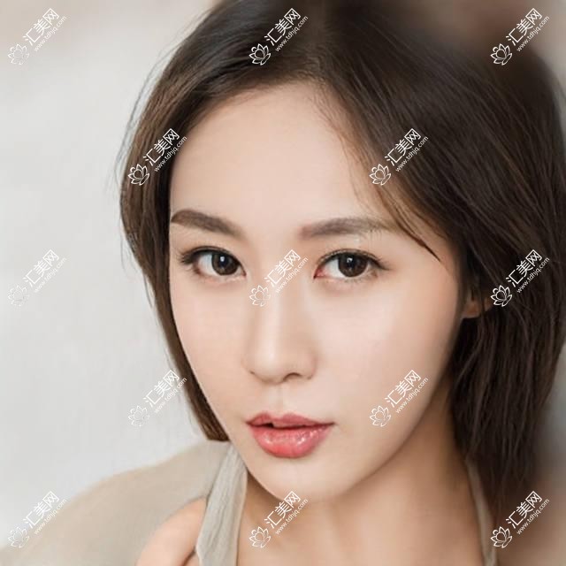 福州眼科医生李伟力、饶惠英、周峥推荐,近视矫治技术精细,口碑优良