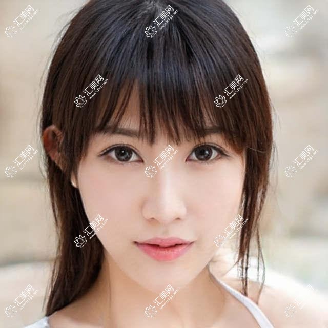 济南眼科医生推荐:马鲁新、张林娜、刘蕾,精通斜视矫正、近视治疗等手术,附服务详情