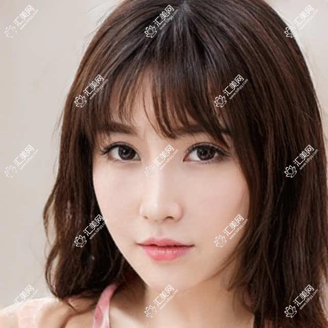 银川丽都医美眼整形费用揭秘?双眼皮8K+ 开眼角5K+ 祛眼袋6K+