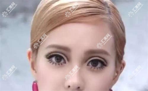 大连眼科鼻部整形名医推荐榜(含特色项目+费用)_重塑美丽必备