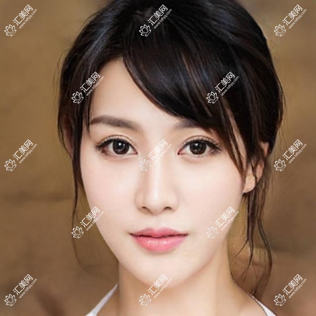 上海市医大眼科飞秒手术多少钱?近视矫正1W+ 白内障2W+ 角膜移植3W+
