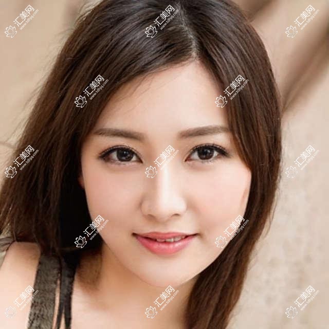 武汉观视界眼科全项目价格表:近视全飞秒