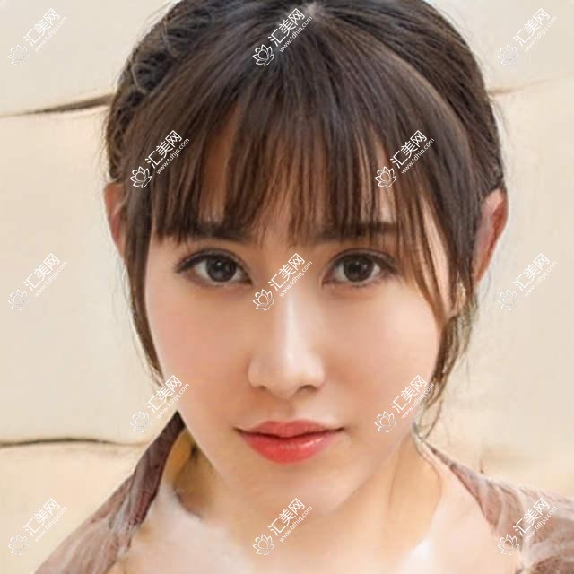 苏州眼科名医排行,李俊欧阳小平张积眼部治疗技术推荐