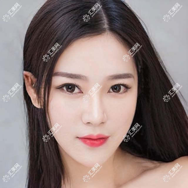 包头眼科整形医生推荐!眼部美容修复,精细技艺,口碑推荐!
