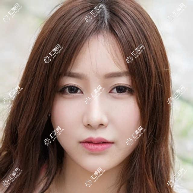 大理有名医生眼部整形及美肤方案精选!网友力荐口碑!