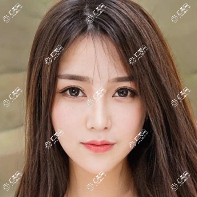 成都龙泉驿欧普眼科全项目价目公开,2万内搞定视力提升,性价比高!