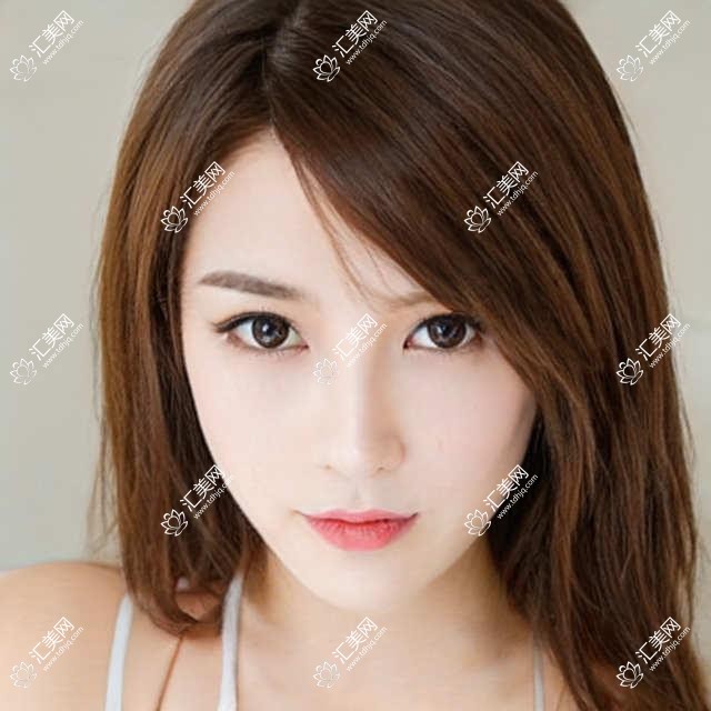 南宁眼科名医推荐:陈蒙刘泉朱格非擅长眼部整形手术