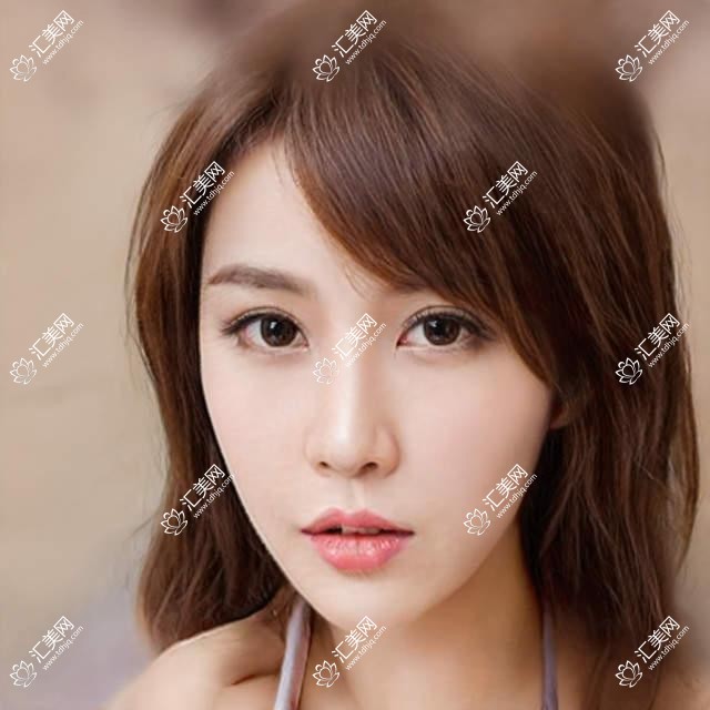 保定眼科医生王平张青蔚韦秋红擅长近视飞秒手术,近视眼治疗选择多