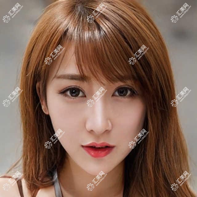 枣庄眼科鼻部整形名医推荐!王兵王皓月精攻青光眼白内障,徐环宇擅美眼翘鼻!