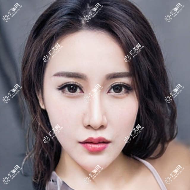 哈尔滨眼科医生推荐:精细全飞秒近视手术,李颖、于永斌等名医坐镇!
