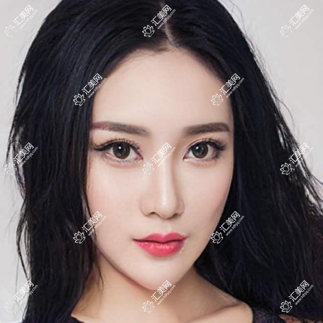 天津市华厦眼科近视矫正价格揭秘:全飞秒亲民价+ICL晶体植入高端选+激光微雕个性方案