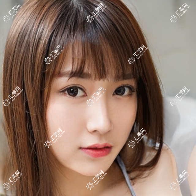 广州视百年眼科全项目价格表:半飞秒/白内障/全飞秒等近视手术+ICL晶体植入费用详览